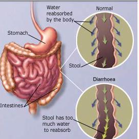 как лечить диарею