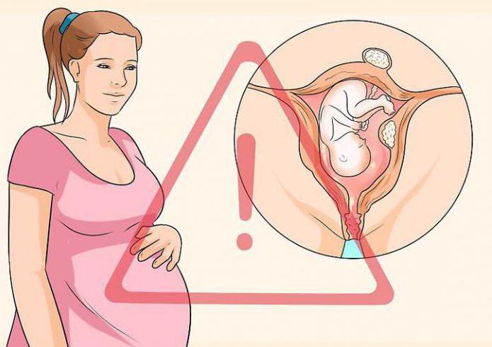 эндометриоз и миома матки можно ли забеременеть