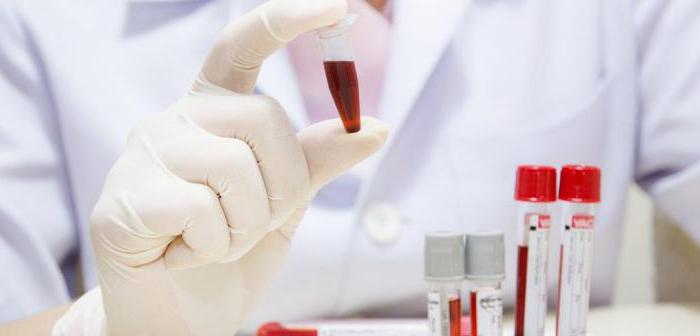 Rdv анализ крови расшифровка повышен thumbnail